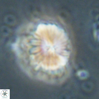 Caycedoae atlanticus 62825