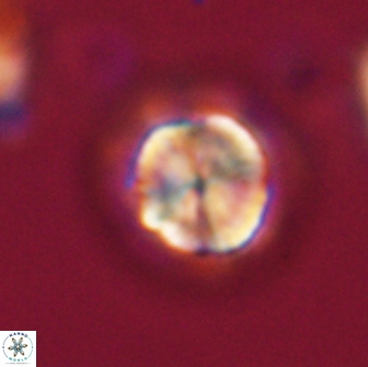 Caycedoae micheliorum 66472