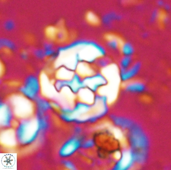 Cervisiella crassa 21788