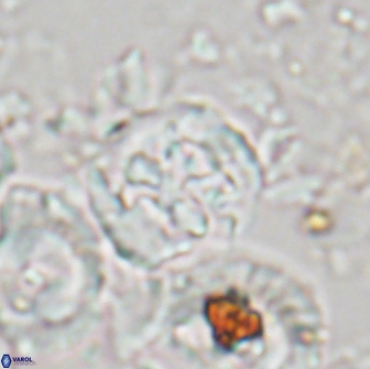 Cervisiella crassa 21790