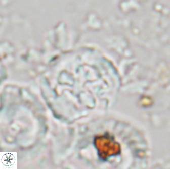 Cervisiella crassa 21790