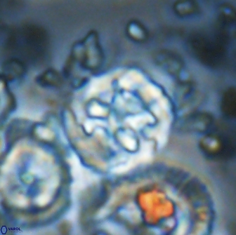 Cervisiella crassa 21791