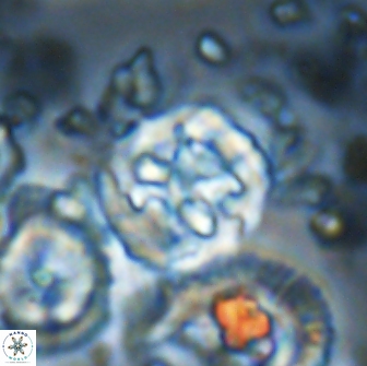 Cervisiella crassa 21791