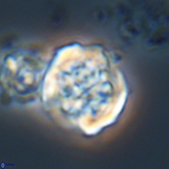 Cervisiella crassa 21889