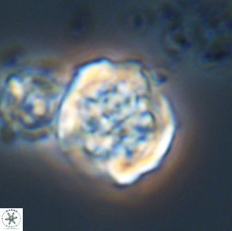 Cervisiella crassa 21889