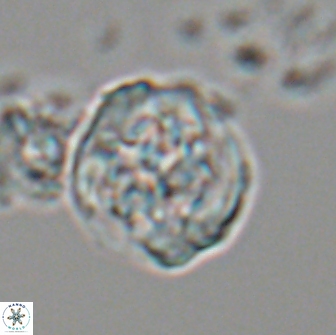 Cervisiella crassa 21890
