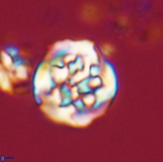 Cervisiella crassa 21891