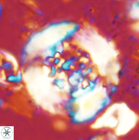 Cervisiella megaloperculata 53908