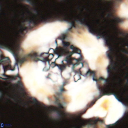Cervisiella megaloperculata 53909