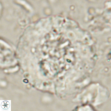 Cervisiella megaloperculata 53911