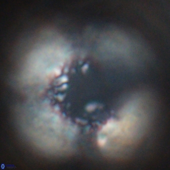 Cervisiella operculata 16035