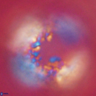 Cervisiella operculata 16036