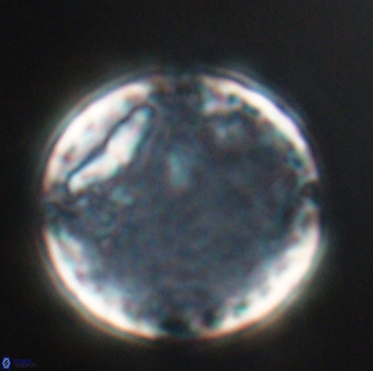 Cervisiella operculata 16037