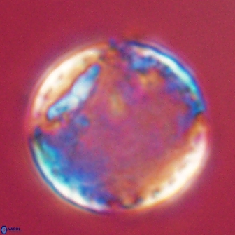 Cervisiella operculata 16038