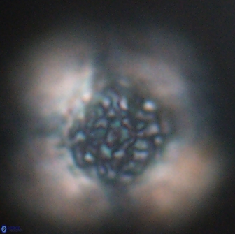 Cervisiella operculata 16039