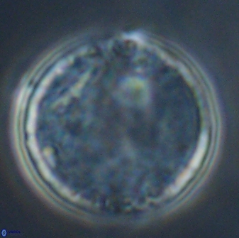 Cervisiella operculata 16044