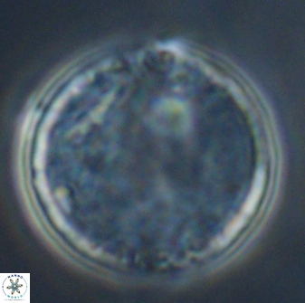 Cervisiella operculata 16044
