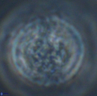 Cervisiella operculata 16045