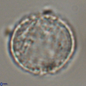 Cervisiella operculata 16041