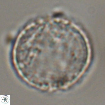 Cervisiella operculata 16041