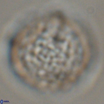 Cervisiella operculata 16042