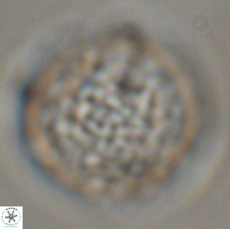 Cervisiella operculata 16042