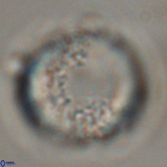 Cervisiella operculata 16043