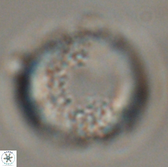 Cervisiella operculata 16043