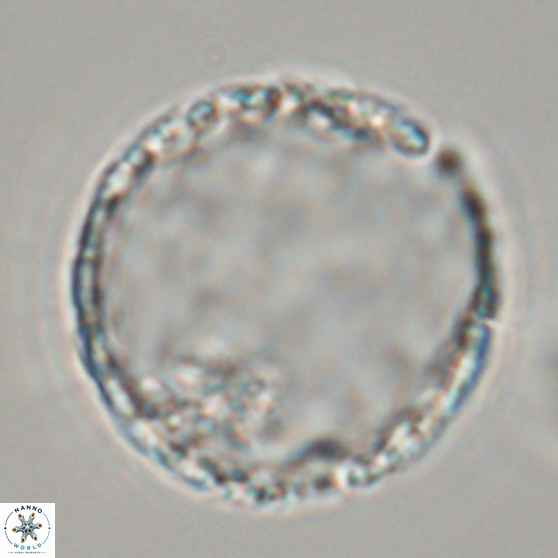 Cervisiella operculata 17784