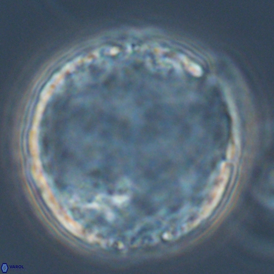 Cervisiella operculata 17786