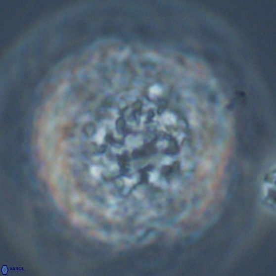 Cervisiella operculata 17787