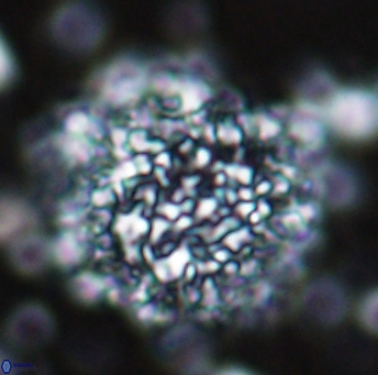 Cervisiella operculata 13225