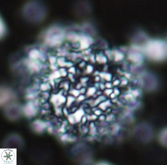 Cervisiella operculata 13225