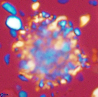 Cervisiella operculata 13221