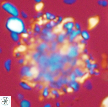Cervisiella operculata 13221