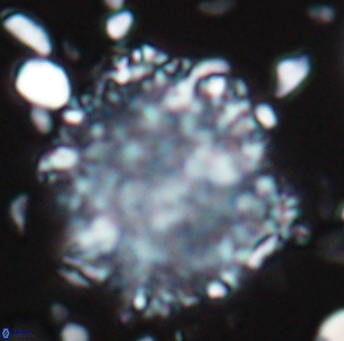 Cervisiella operculata 13222