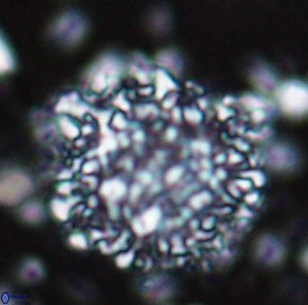 Cervisiella operculata 13223