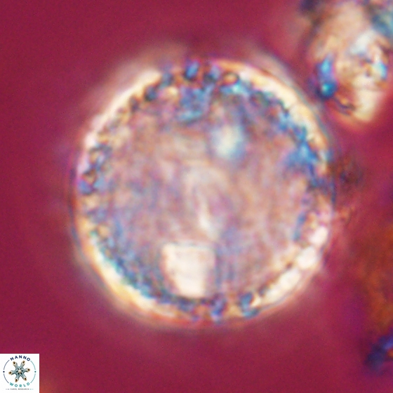 Cervisiella operculata 13827