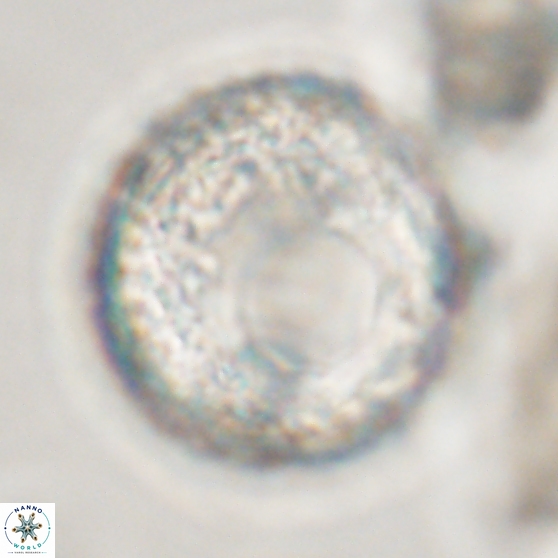 Cervisiella operculata 13834