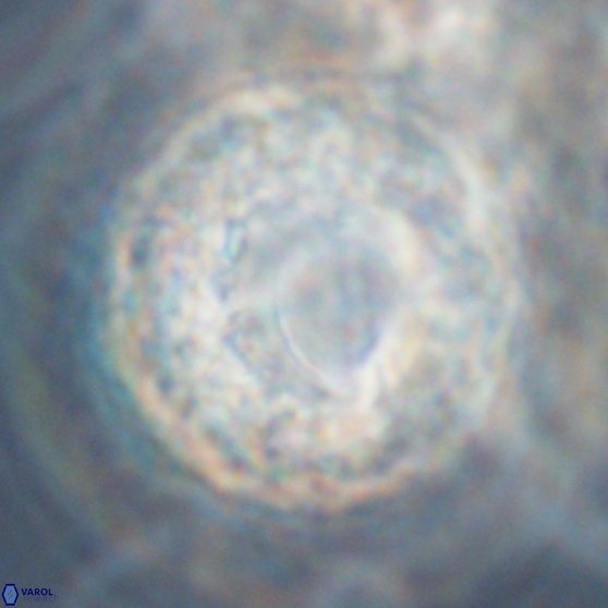 Cervisiella operculata 13836