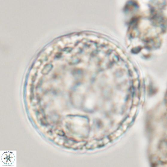 Cervisiella operculata 13833
