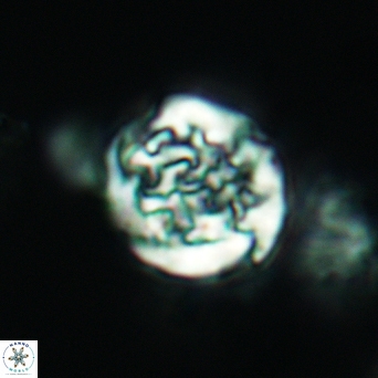 Cervisiella operculata 2989