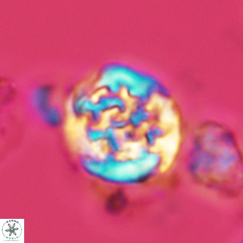 Cervisiella operculata 2990