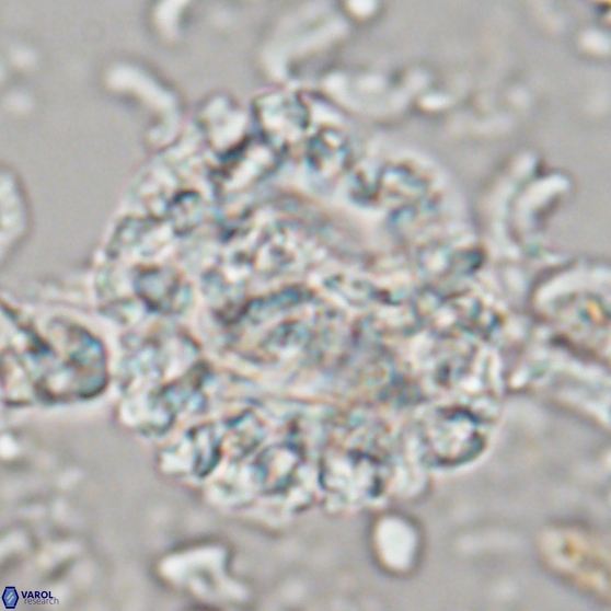 Cervisiella operculata 21786