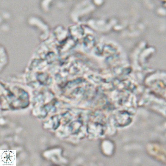 Cervisiella operculata 21786