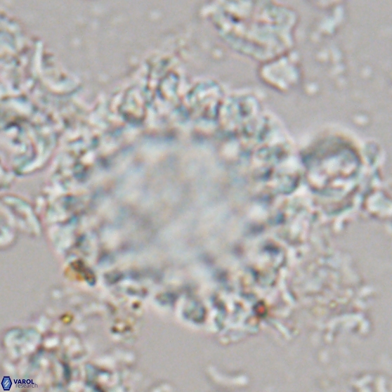 Cervisiella operculata 21780