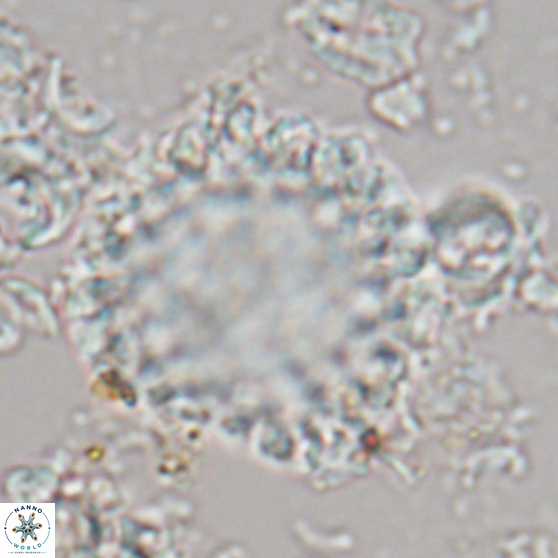 Cervisiella operculata 21780
