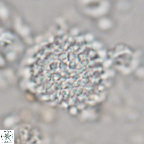 Cervisiella operculata 21781