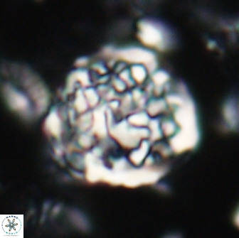 Cervisiella operculata 21818