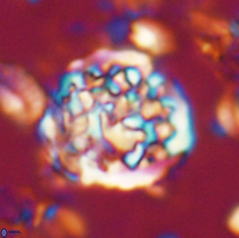 Cervisiella operculata 21819